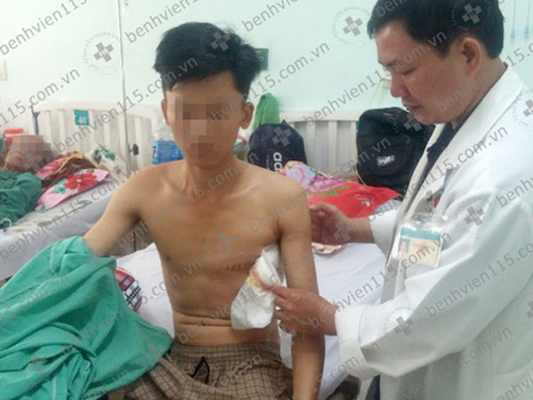 TP.HCM: Đi ăn tiệc về lúc nửa đêm, nam thanh niên 28 tuổi bị đâm thấu tim nguy kịch