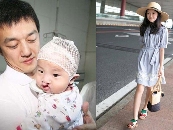Con gái của Lý Á Bằng: Nỗi đau khuyết tật và sự mạnh mẽ khó tin của cô bé 12 tuổi