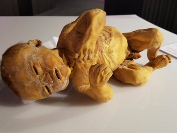 Triển lãm cơ thể và nội tạng của xác người thật được nhựa hóa ở Sài Gòn gây tranh cãi