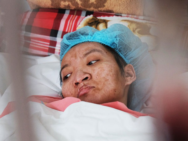 TP.HCM: Thương tâm cảnh thai phụ trẻ và người yêu bỏng nặng vì cháy nhà trước ngày cưới