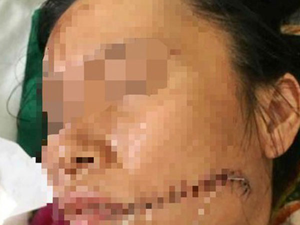 Rạch mặt người tình rồi tưới xăng thiêu sống để 'chết chung'