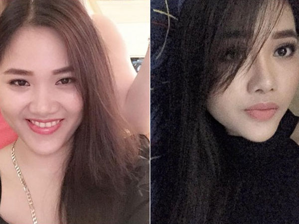 Bị chồng cũ chê răng 'thò thụt mất trật tự', ly hôn xong mẹ trẻ bỏ 40 triệu đi niềng răng, vô tình lột xác đến ngỡ ngàng