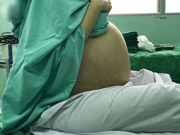 Thường xuyên ăn đêm, cô gái 20 tuổi nghĩ mình béo bụng chủ quan không đi khám suýt chết vì mang u buồng trứng khổng lồ