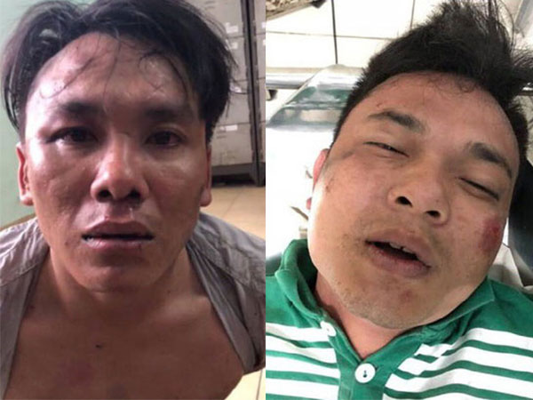 Hai thanh niên cướp xe máy, cầm mã tấu cố thủ trong khách sạn, công an nổ súng vây ráp