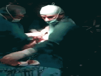 Hiếm thấy: Clip sinh mổ khiến các bác sĩ trong nghề lẫn người xem 'nín thở' vì đếm mãi không hết số thai nhi
