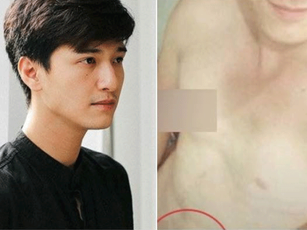 Huỳnh Anh nói gì trước nghi vấn lộ ảnh nóng