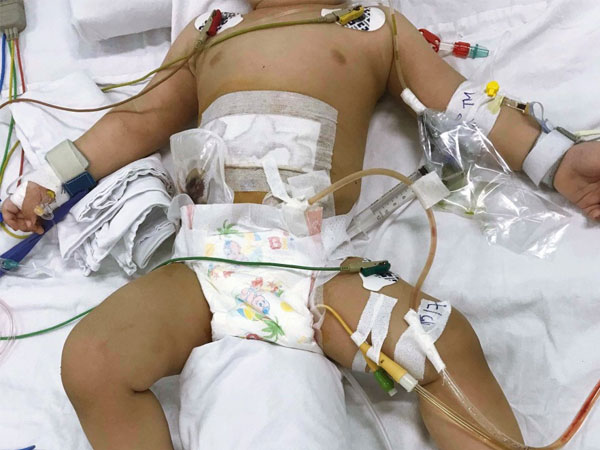 Vụ bé trai nghi bị mẹ ruột mắc bệnh tâm thần đâm thủng ruột ở Sài Gòn: Người mẹ có phải chịu trách nhiệm hình sự?