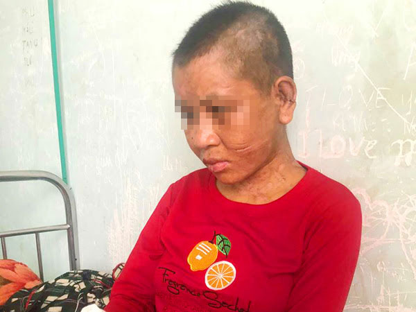 Vụ người phụ nữ bị tra tấn ở Gia Lai: Đối tượng nói bị bỏ thuốc thư?
