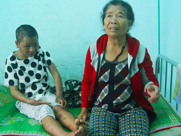 Hành trình tháo chạy khỏi 'địa ngục' của nữ 9X bị tra tấn tàn bạo