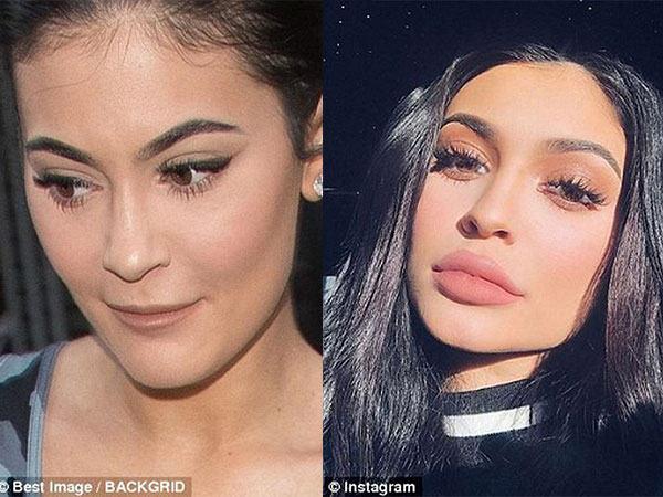 'Nữ hoàng môi tều' Kylie Jenner gây xôn xao vì đôi môi mỏng dính khó nhận ra sau khi rút filler