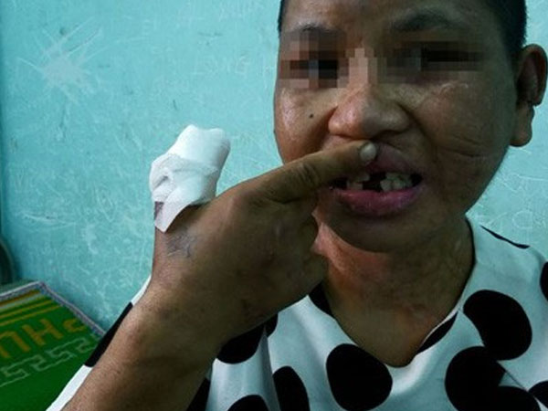 Vụ hành hạ dã man người làm công: Cứ 'chơi đá' là ra tay tra tấn