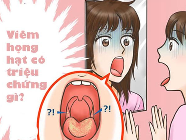 Triệu chứng viêm họng hạt là gì?