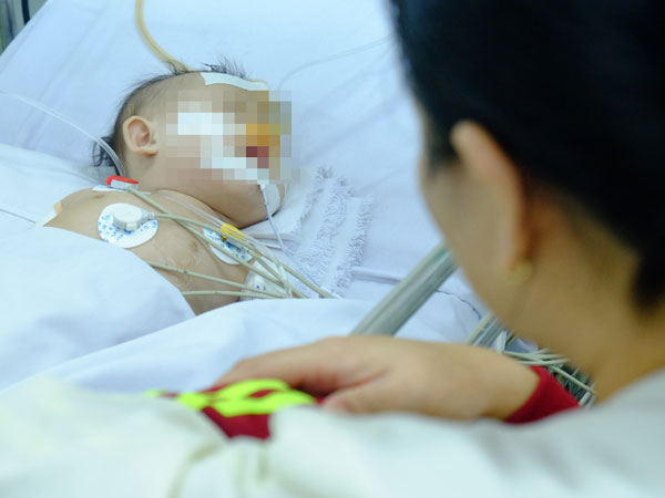 Uống nhầm nước tro tàu làm bánh ú, bé gái 3 tuổi bị bỏng thực quản