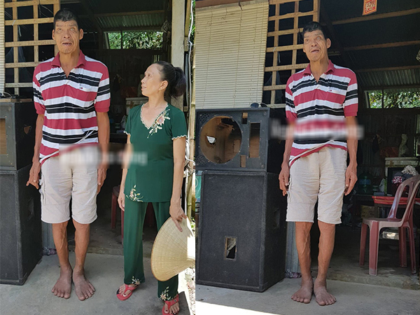 Cuộc sống khó khăn của người 'khổng lồ' cao hơn 2,1 m ở miền Tây