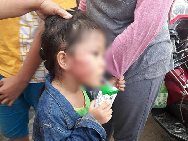 Phát hiện thêm hành vi bạo lực của bảo mẫu tát bé gái nứt xương hàm