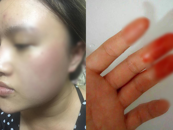 Nữ sinh bị nam chủ nhà tát, đuổi ra khỏi nhà trọ lên tiếng: 'Nhiều lần tôi còn cho hai vợ chồng ấy vay tiền, mượn xe...'