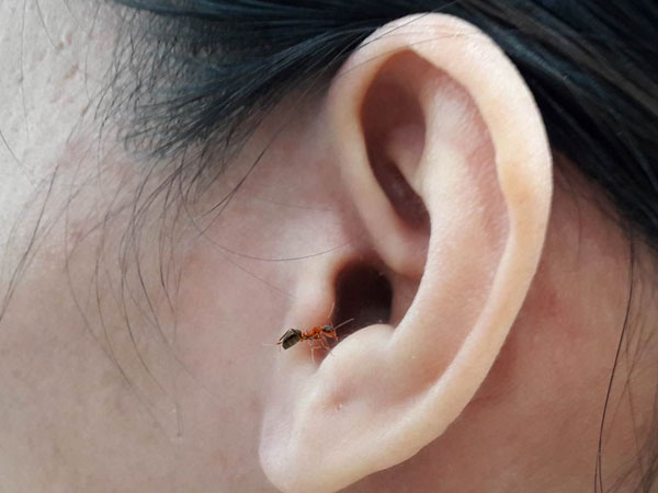Côn trùng chui vào tai: Tai nạn trời ơi đất hỡi này phải xử lý sao mới đúng?