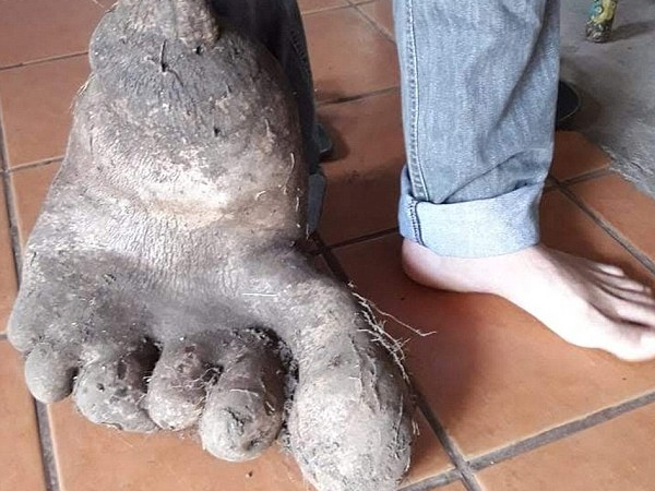 Củ khoai tây khổng lồ giống hệt bàn chân người