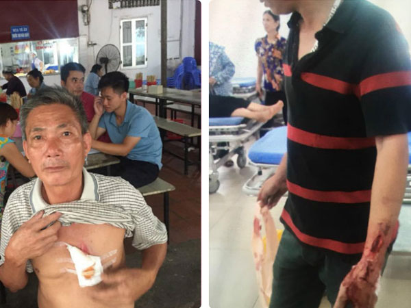 Hà Nội: 5 người cùng nhà bị truy sát phải nhập viện