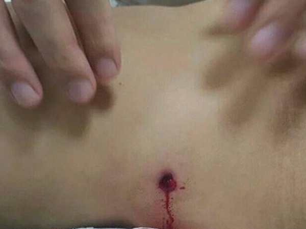 Nam Định: Côn đồ bắn nhau ở chân cầu Đò Quan, một người dân trúng đạn tử vong