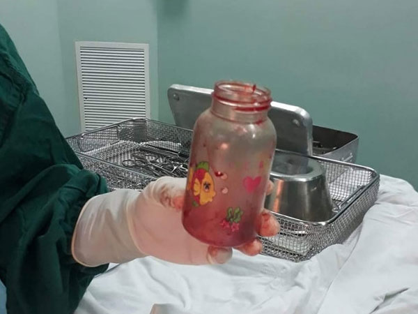 Người đàn ông nhét bình sữa vào... hậu môn để trị thoái hóa cột sống