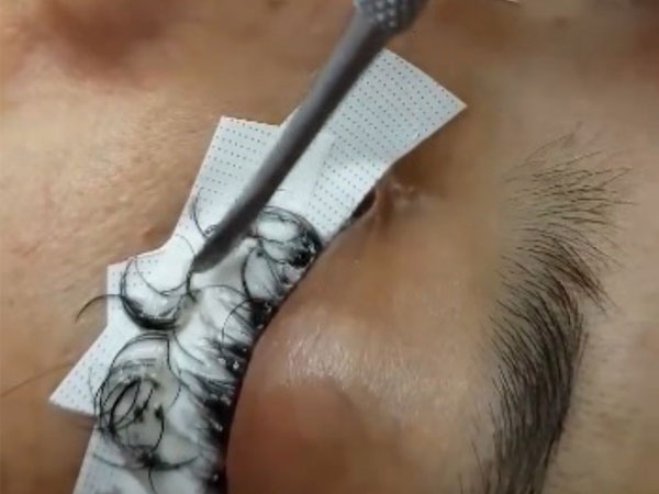 Cô gái đau đớn lĩnh hậu quả với đôi mắt sưng húp, rụng sạch lông mi vì nối mi bằng keo dán sắt