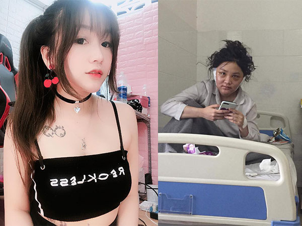 Lộ ảnh Kiều Anh Hera mặt sưng phù, da dẻ sần sùi khi vừa tỉnh dậy sau 6 tiếng PTTM