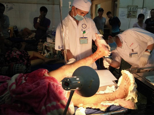 Nam thanh niên bị chém đứt lìa 2 cẳng chân