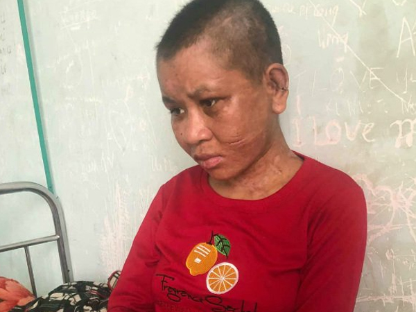 Truy tìm 5 nghi can cùng chủ nhà bạo hành dã man người giúp việc