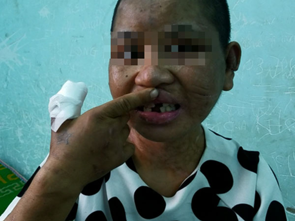 Vụ Nga 'vọc' tra tấn dã man: Yêu cầu thêm 5 người liên quan đến làm việc