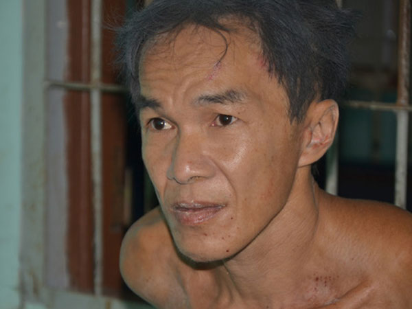 Kẻ giết người, cắt đầu nạn nhân mắc bệnh tâm thần