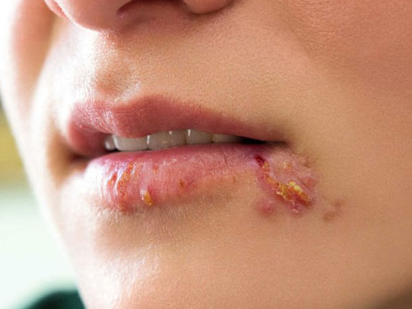 Ảnh bìa bài viết 559951