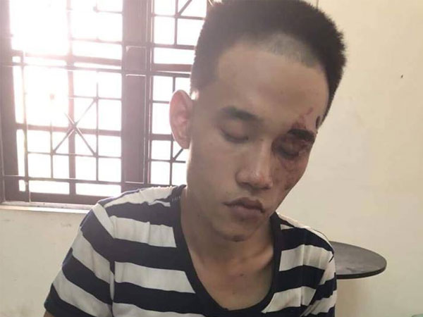 Chân dung nghi phạm 23 tuổi vô cớ cứa cổ người đàn ông đến dự đám tang bố ruột