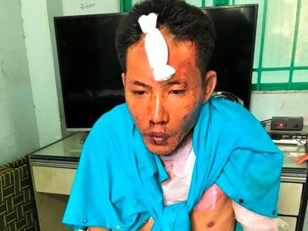 Đồng Nai: Bực tức vì bị vợ đuổi ra khỏi nhà, chồng mua xăng về đốt khiến 3 mẹ con nguy kịch