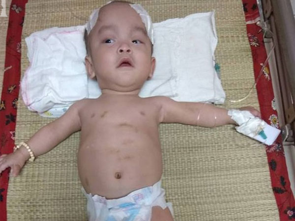 Sinh ra nặng chỉ 1kg, bé trai 14 tháng tuổi đau đớn chống chọi với căn bệnh quái ác
