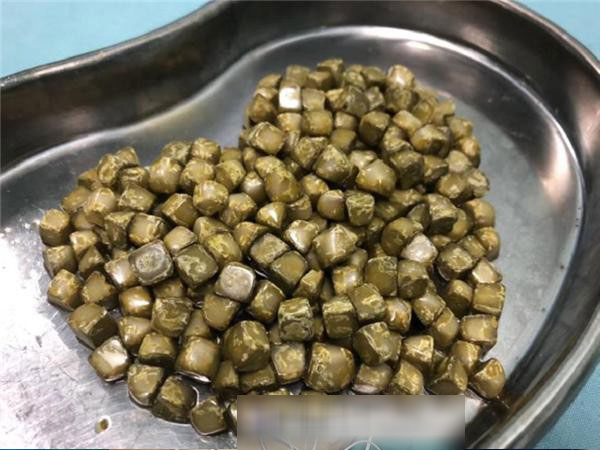 Nếu là nữ giới thì cần đặc biệt ghi nhớ những điều sau để không gặp phải sự cố kinh hoàng như người phụ nữ này