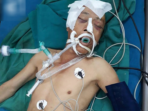 TP.HCM: Người đàn ông chấn thương sọ não vì tai nạn vẫn chưa có người thân vào nhận sau 2 ngày nằm viện