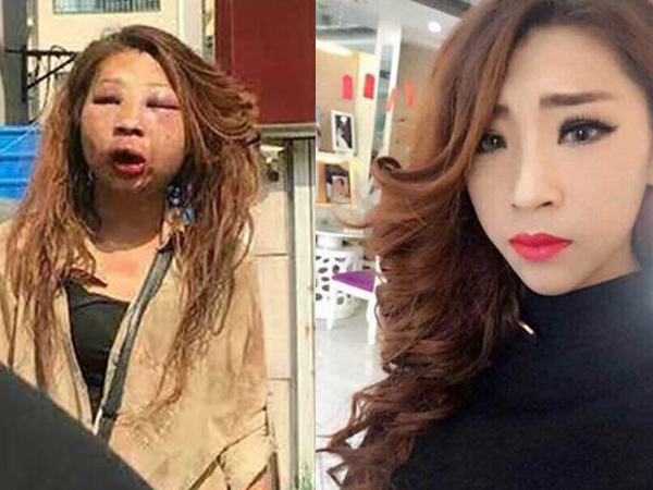 Cặp kè với người đã có vợ, hotgirl bị đánh ghen tới biến dạng mặt mũi