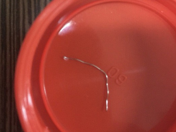 Chuyện hy hữu: Nuốt thanh kẽm dài 7 cm mà không hay biết
