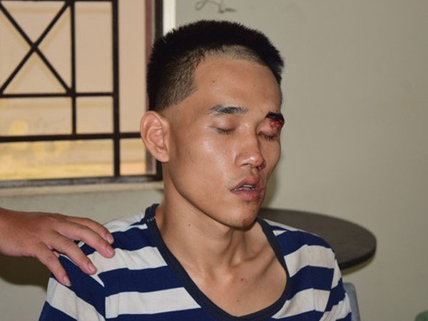 Bắt đối tượng dùng dao giết chết người đến viếng đám tang cha mình