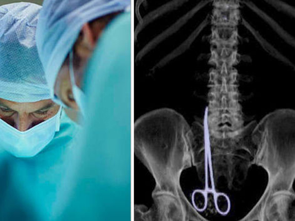 Tưởng bị ung thư, hóa ra kéo dài 15cm nằm trong bụng 6 tháng