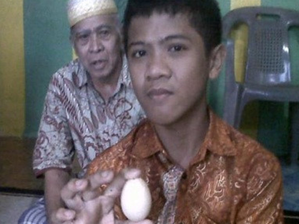Sự thật bí ẩn gây sốc cậu bé biết đẻ trứng ở Indonesia