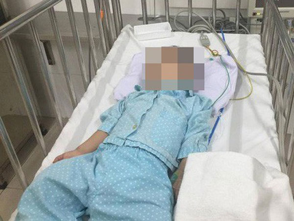 Bé 5 tuổi bị bạn trai của chị họ đánh chấn thương sọ não