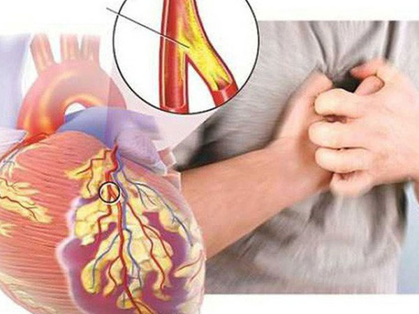 Những bệnh nguy hiểm người ăn nhiều thịt dễ mắc phải, cần điều chỉnh ngay
