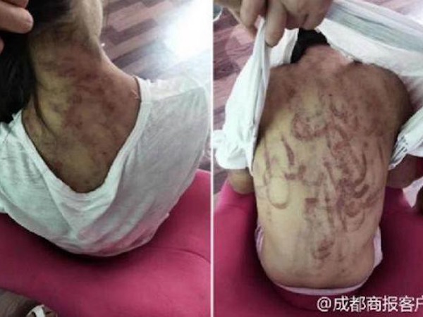 Mẹ kế hành hạ con gái riêng của chồng thân tàn ma dại, cơ thể rớm máu, người bố nhẫn tâm nói 'đánh thế là đúng'
