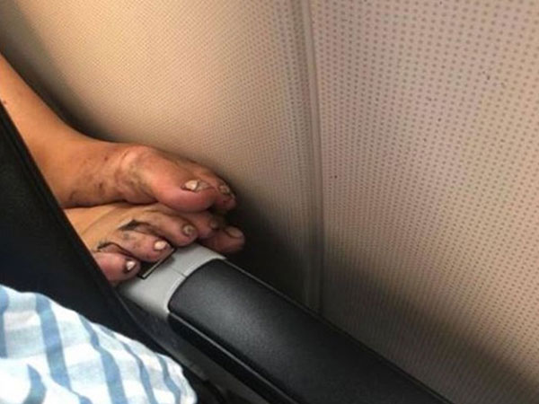 Đôi chân cáu bẩn và kém duyên khiến dân mạng kinh hồn bạt vía, nhưng cách mô tả của 'nạn nhân' lại gây tranh cãi