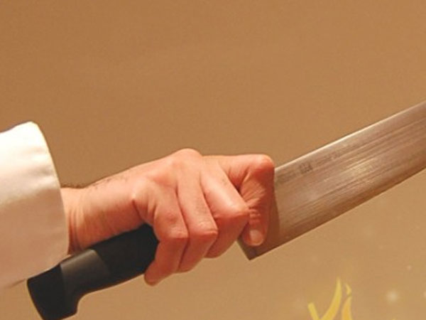 Tản mạn về... cắt 'của quý'