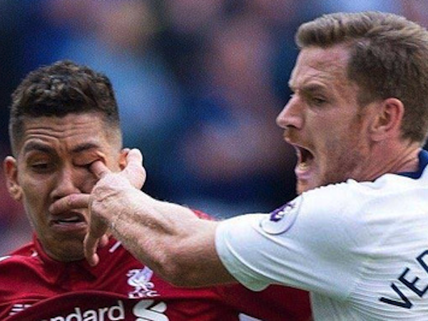 Firmino dính chấn thương vì bị... chọc vào mắt