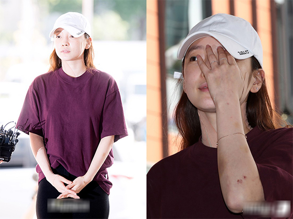 Goo Hara lần đầu lộ diện sau vụ hành hung: Mặt sưng vù, cổ và tay đầy vết bầm máu và băng bó nghiêm trọng