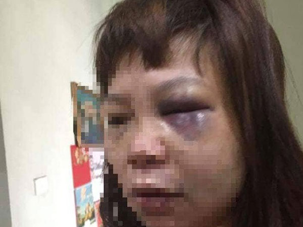 Chồng 'dụ' vợ lên đồi đánh đập dã man ở Quảng Ninh: Bắt tạm giam người chồng để điều tra